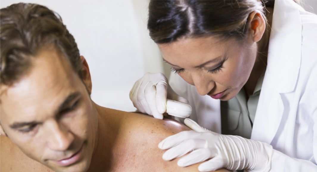 Free Skin Cancer Screening | Bliss Dermatology Englewood Care Clinic