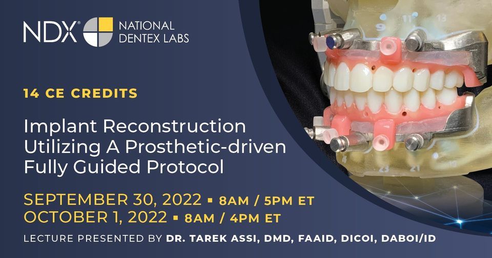 Implant Reconstruction Utilizing A Prosthetic-driven Fully Guided Protocol