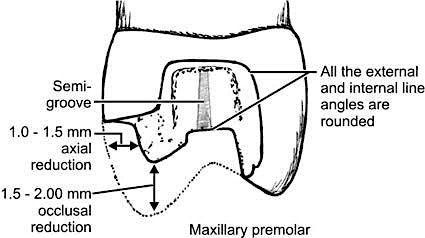Advanced Restorative Techniques for Oral Health Professionals