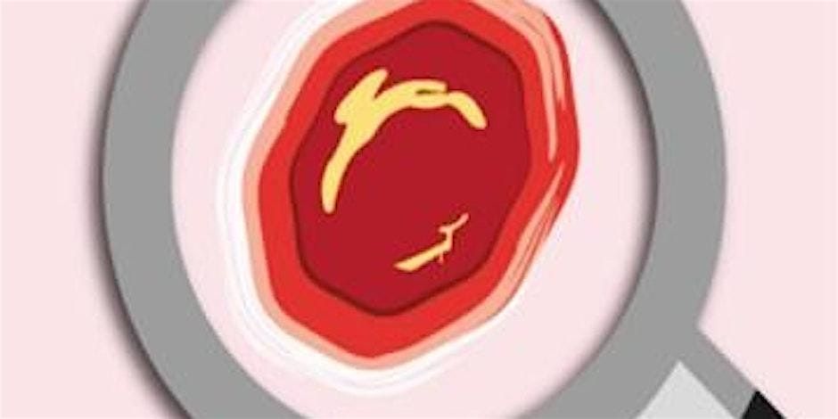 PUPIS Pressure Management and Inhouse training - 24th November 2025