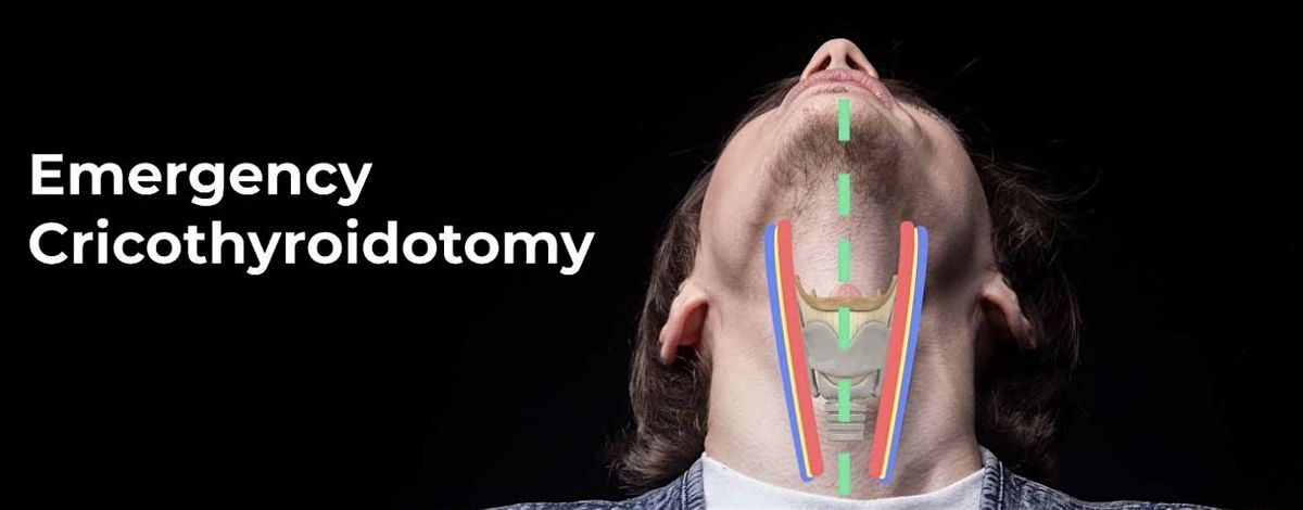 Emergency Cricothyrotomy Hands-On