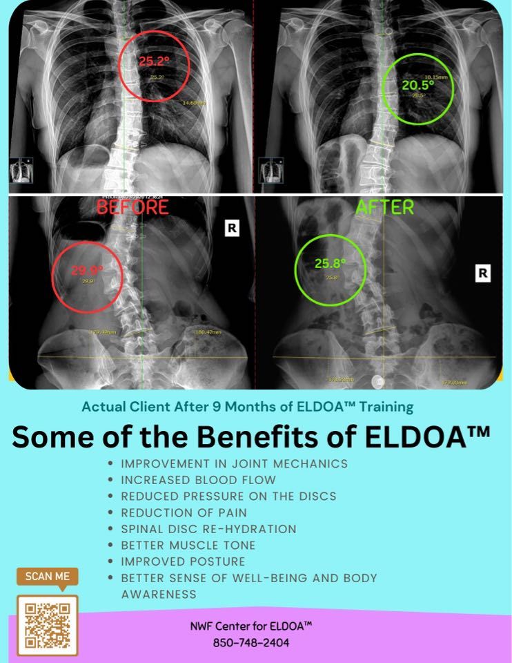 ELDOA Workshop with NWF Center for ELDOA 