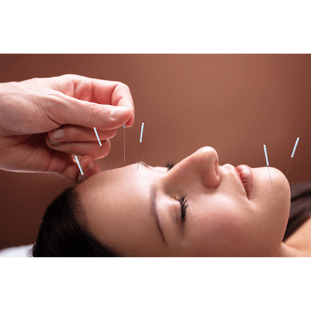 Acupuncture and Sound Bath on Mattresses