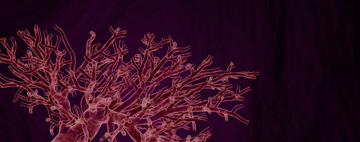 3D Modeling for Cardiac Surgical Planning