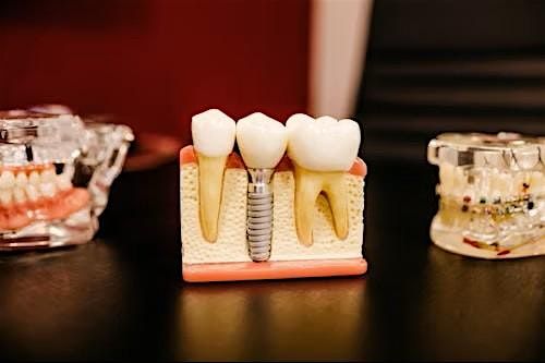 The Issue of the Tissue Around Teeth and Implants