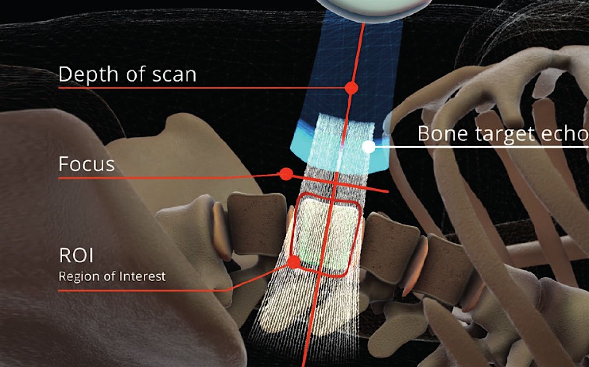 REMS Bone Scan Event \u2013 Track & Improve Your Bone Health Naturally