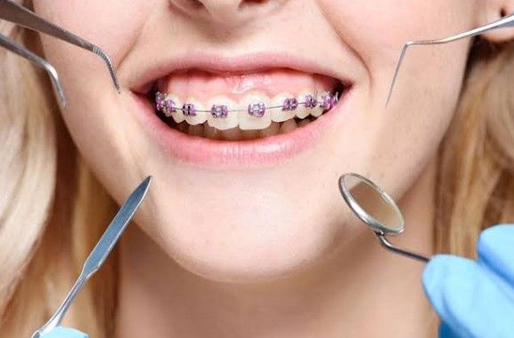 CFDHA Presents Updates in Orthodontics