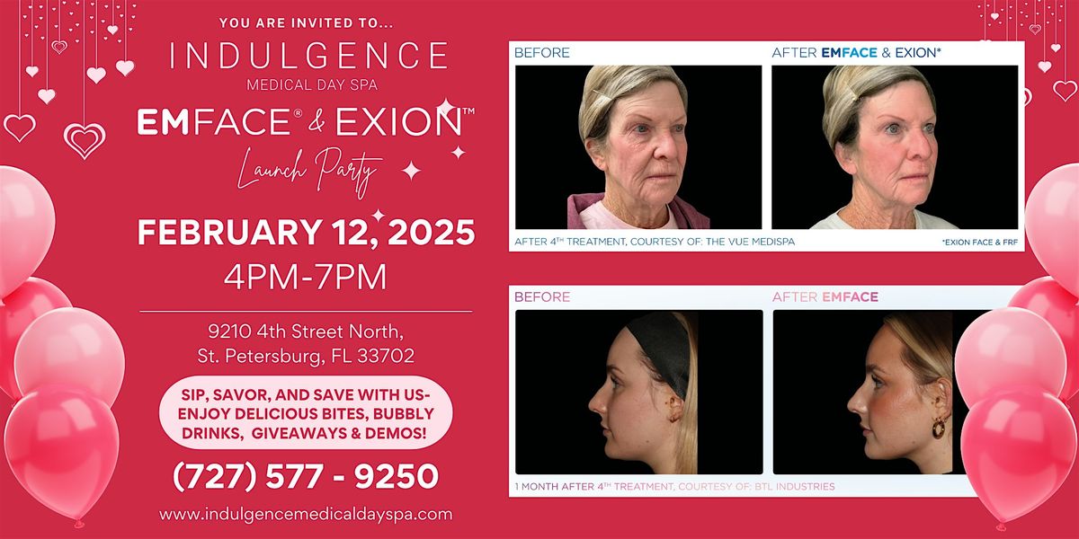 EMFace and Exion Valentines Launch Event