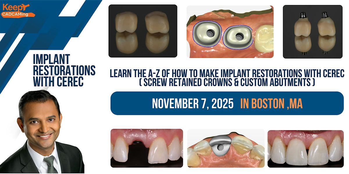 Implant  Restorations  with CEREC (Boston,MA)