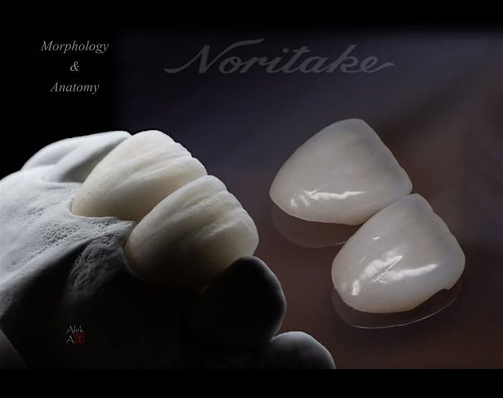 Communication et esth\u00e9tique entre dentistes et proth\u00e9sistes