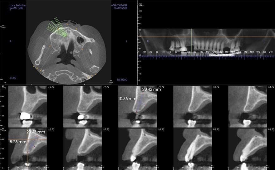 Cone Beam  Computed Tomography-Overview, Safety, and Applications