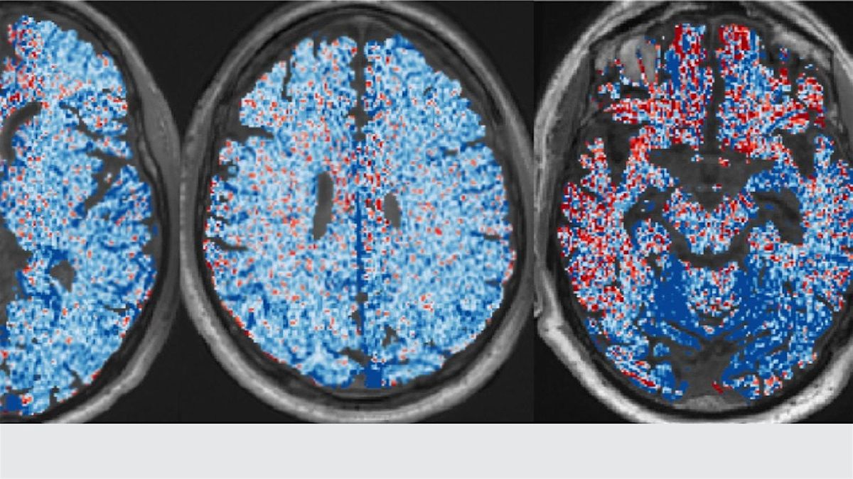 Brain Injury & Concussion: Lessons from the Battlefield,  Ball Field & Lab