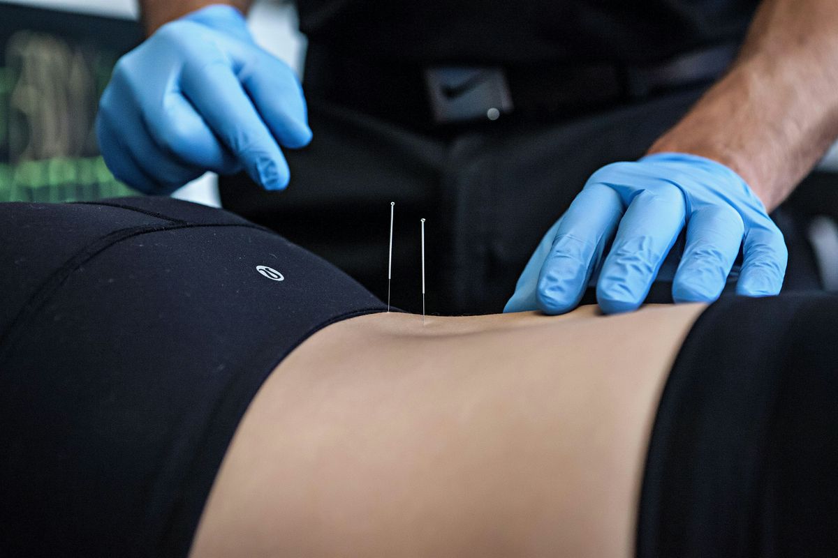 Level 1 Dry Needling Certification - Two Days