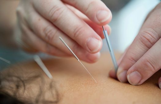 North East Acupuncture & Dry Needling Foundation Course