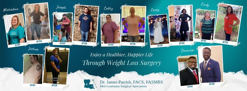 BARIATRIC WEIGHT LOSS SEMINAR WITH DR. JAMES PARRISH