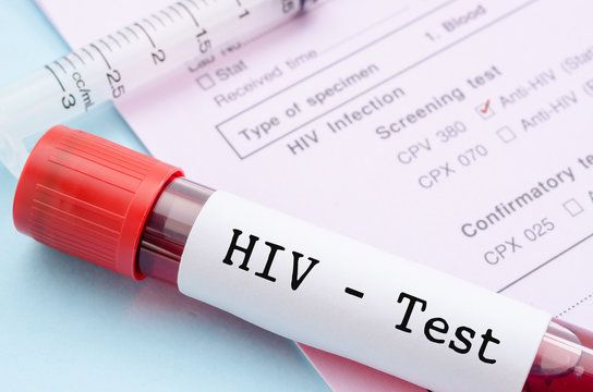 HIV Testing with CAN HIV