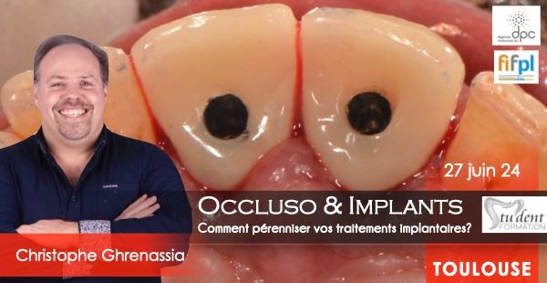 Occluso & Implants