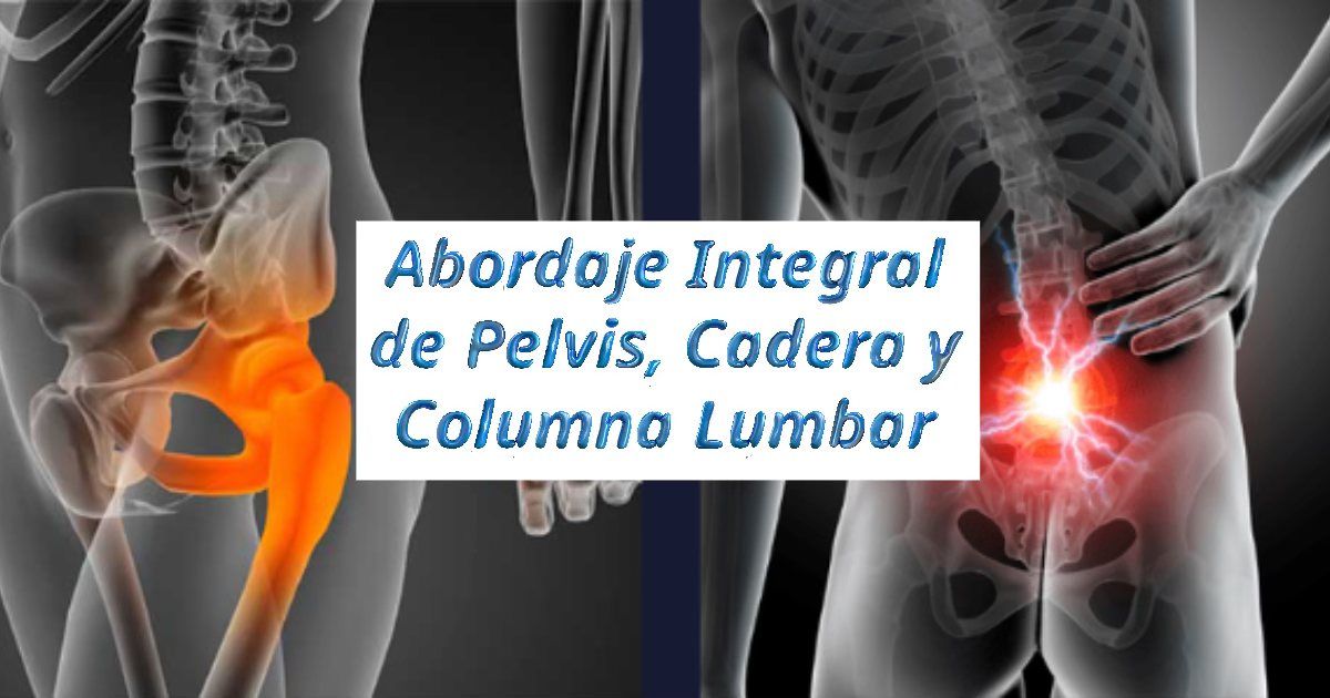 Abordaje Integral de Pelvis, Cadera y Columna Lumbar