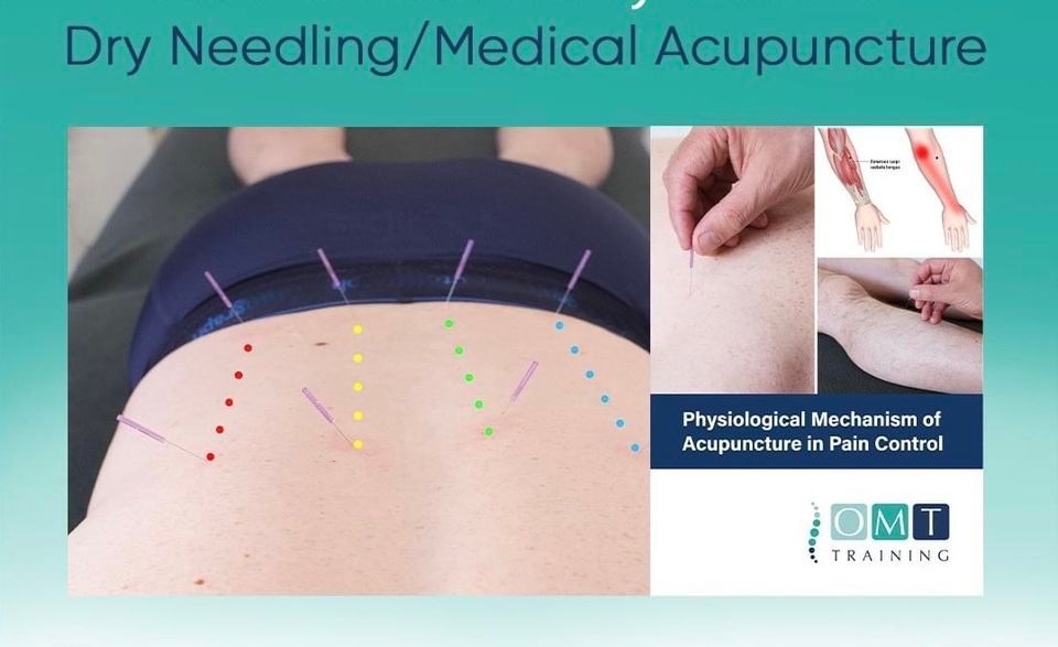 Scotland - Medical Acupuncture Level 1