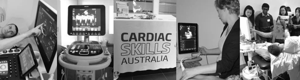 FOCUSSED CARDIAC ULTRASOUND - PERTH