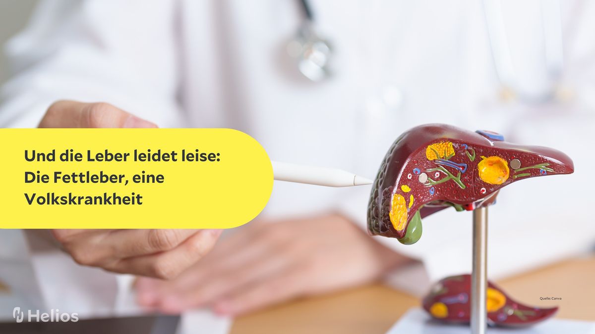 Gesundheitsvortrag: Und die Leber leidet leise: Die Fettleber, eine Volkskrankheit