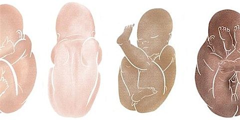 Physiological Breech Birth Study day