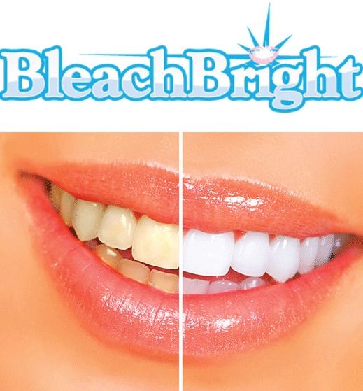 Pop-Up Tooth Whitening Party