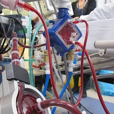 Queensland Neonatal and Paediatric ECLS Service