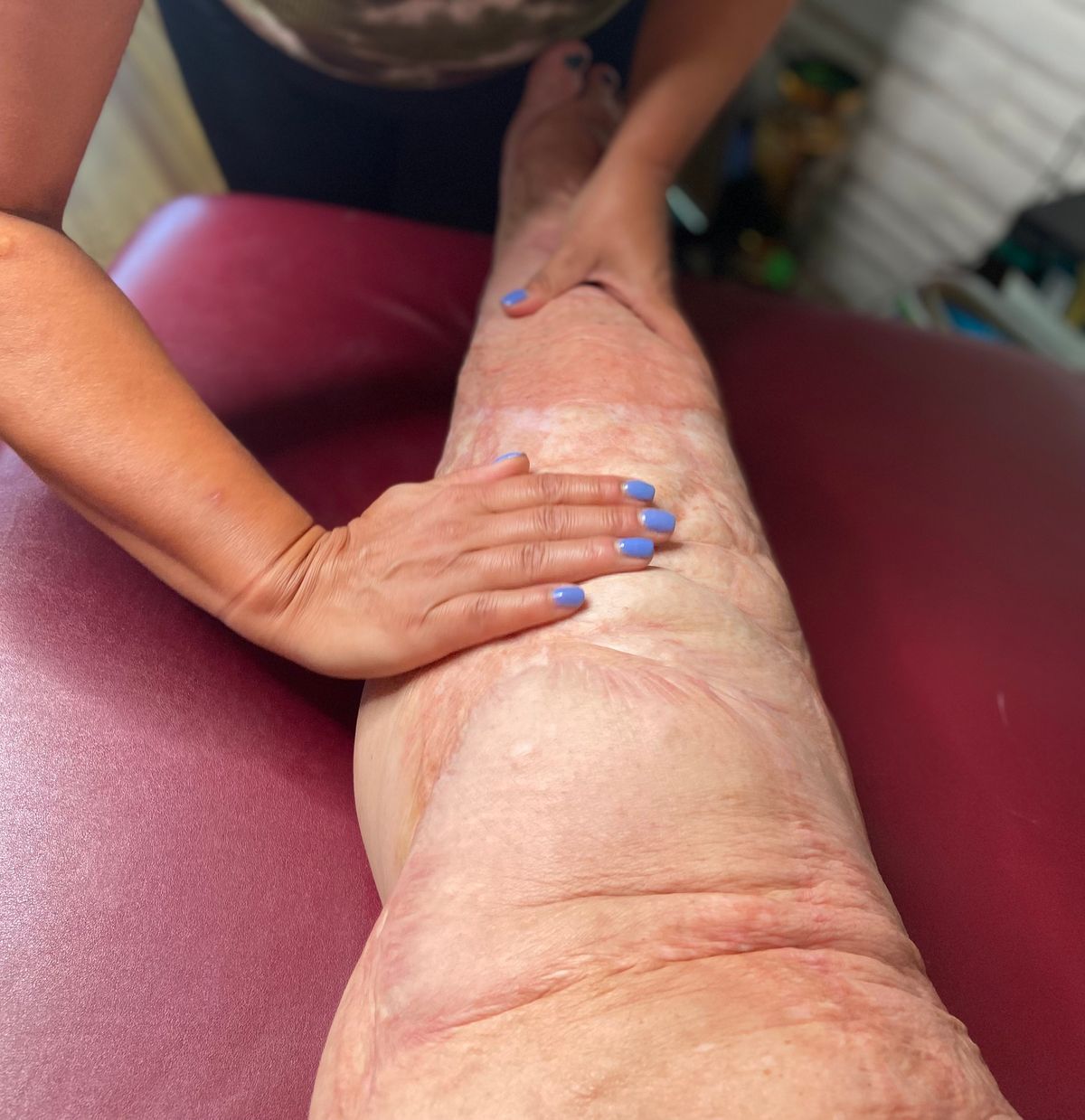 San Antonio, TX-8 CE Burn Scar Massage Therapy Class