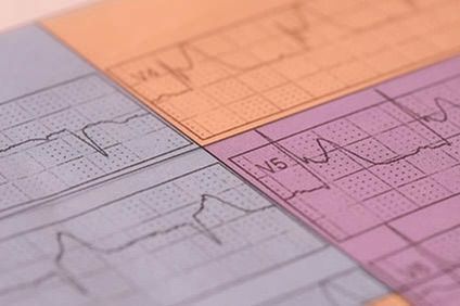 12-lead ECG interpretation in ACS 