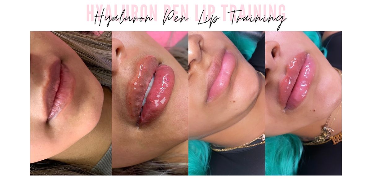 HYALURON PEN LIP TRAINING NO NEEDLE LIP FILLER HANDS ON, HOUSTON