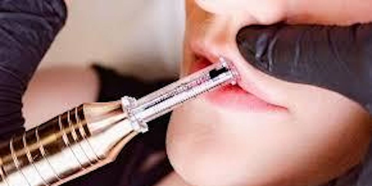 New York, Ny Hyaluron Pen Training, Learn to Fill in Lips & Dissolve Fat!