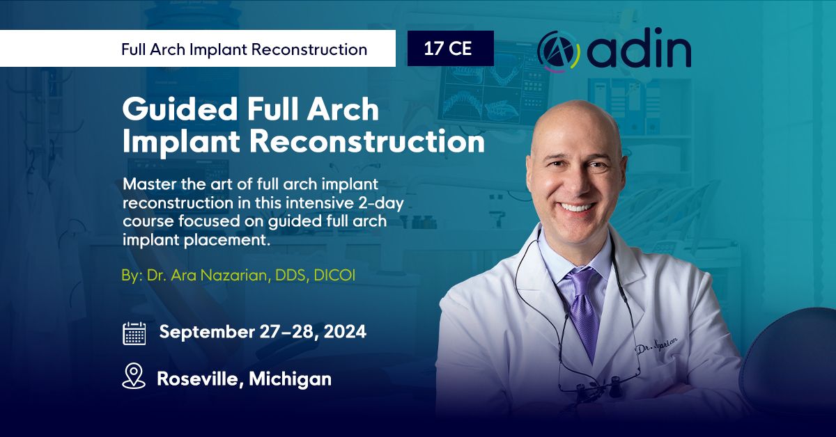 Guided Full Arch Implant Reconstruction